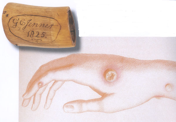 cowpox KLS edited