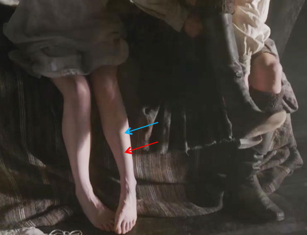 ep-107-Claires-legs-01-KLS-edited-1