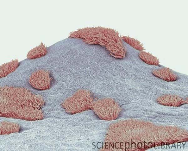 respiratory epithelium KLS edited