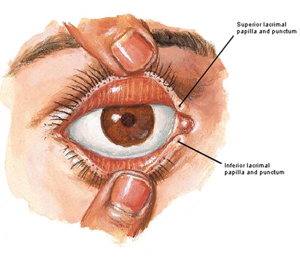 Figure0077A lacrimal papillae and punctum KLS edited