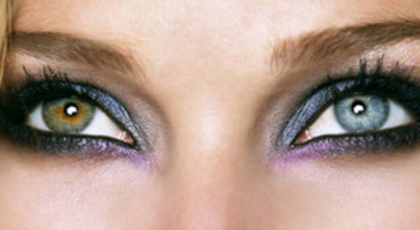 heterochromia-KLS-edited