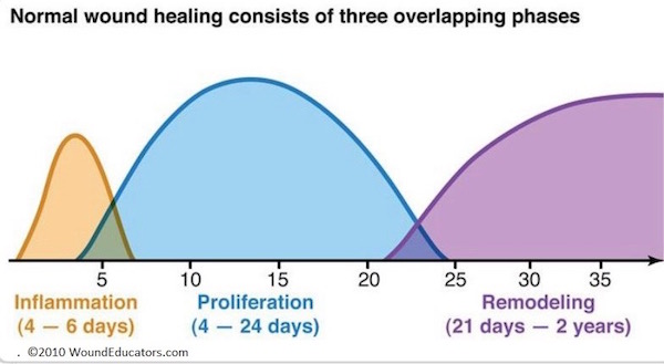 phases of wound healing