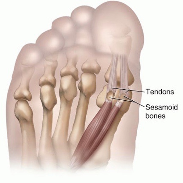 Sesamoid bones KLS edited