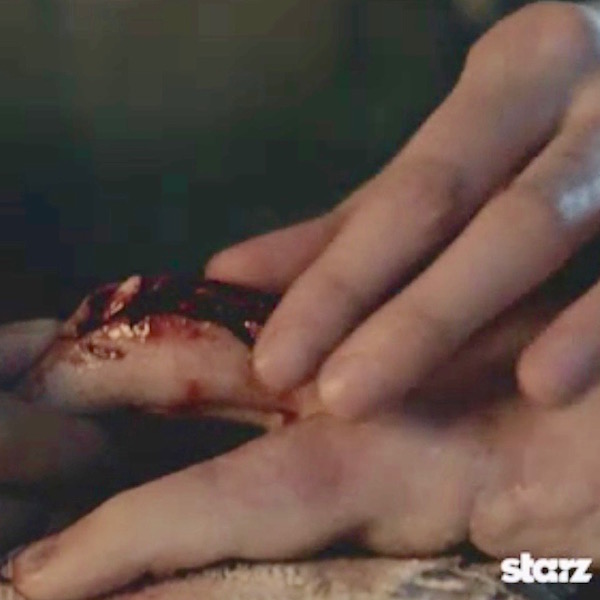 ep 116 Jamie hand 02 KLS edited