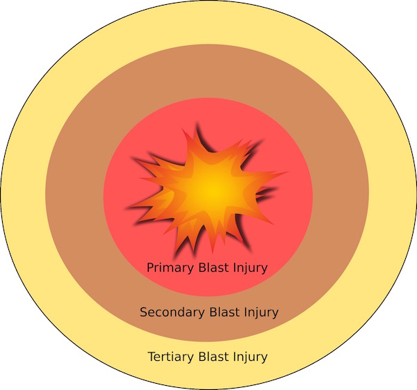 Blast map