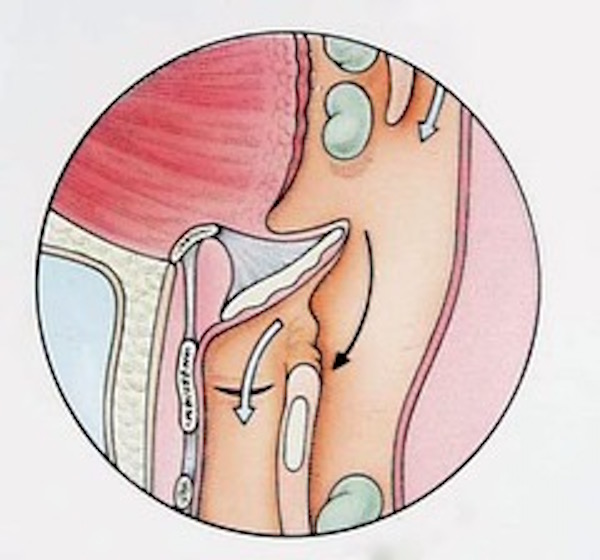 epiglottis