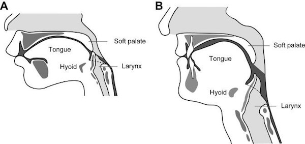 infant & adult larynx