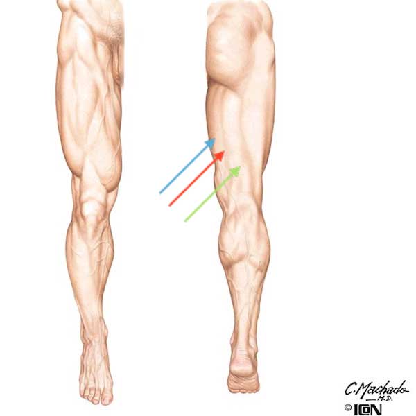 figure0467-thigh-01-c