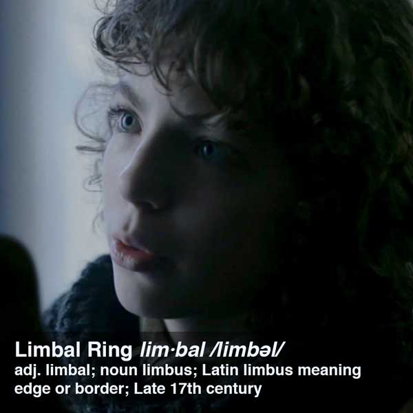 limbal-ring