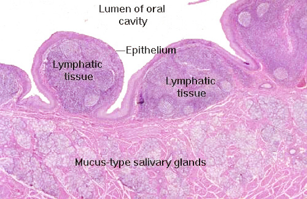 g-tonsils