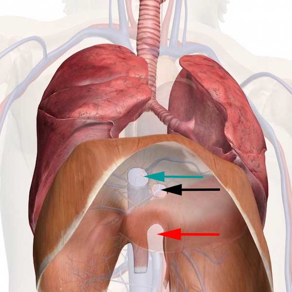 u-diaphragm