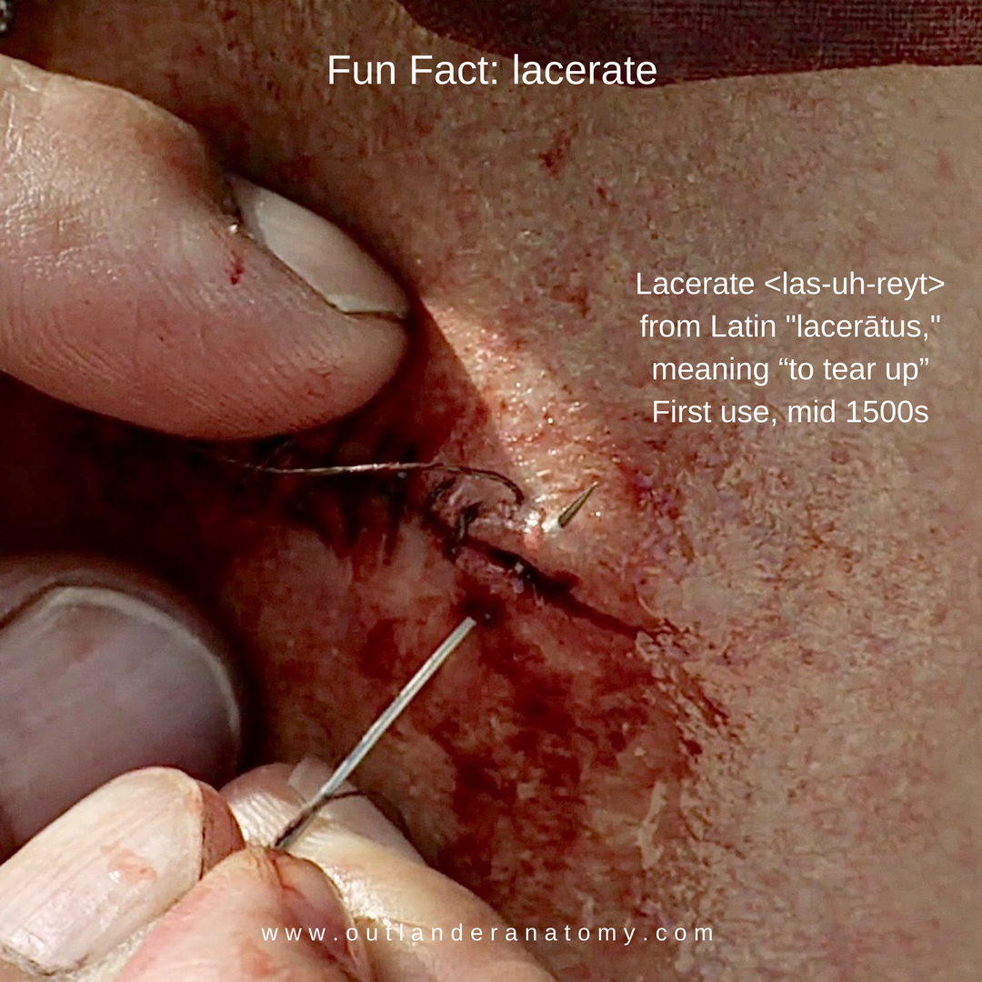 image of a laceration being stituced up