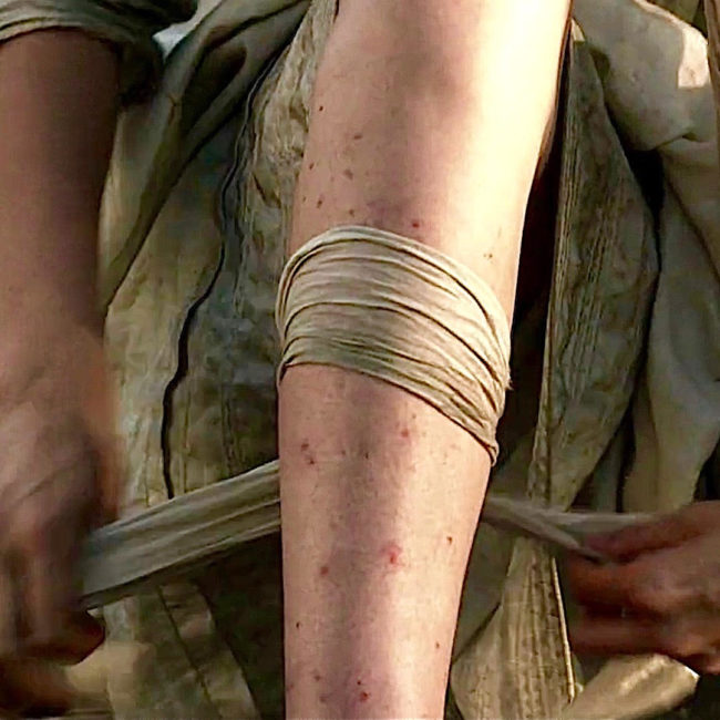 ant bites on Claire Fraser's leg from Outlander TV show