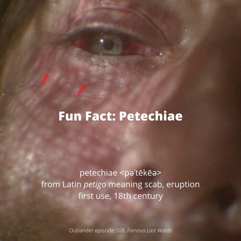 Fun Fact Petechiae Outlander Anatomy