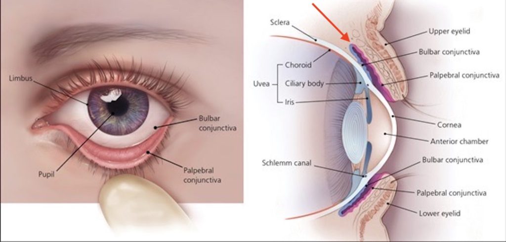 Eye Anatomy Conjunctiva Sclera Eye Anatomy Conjunctiva Sclera